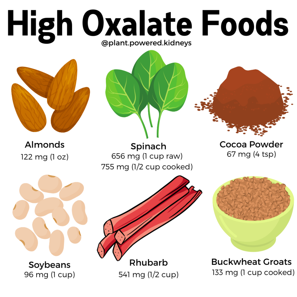 Foods to avoid in kidney stones