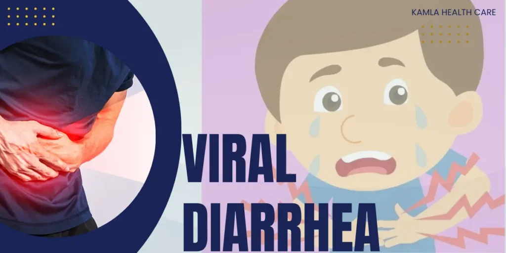 Viral Diarrhea